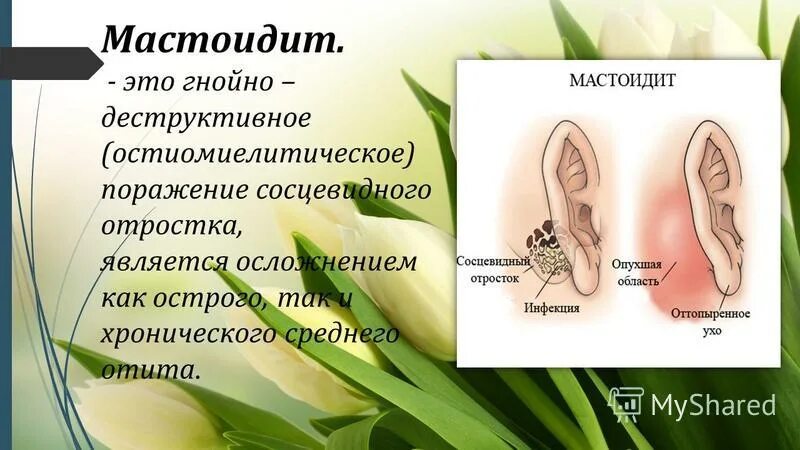 Сосцевидный отросток височной кости анатомия. Классификация ячеек сосцевидного отростка. Анатомия среднего уха и сосцевидного отростка. Сосцевидный отросток черепа анатомия. Сосцевидный отросток черепа анатомия.