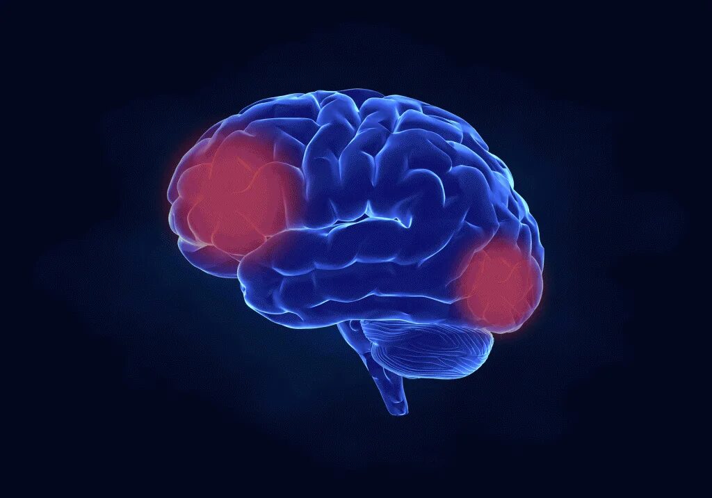 Презентация опухоль мозга. Мозг и рецепторы. Мозг человека с эпилепсией.