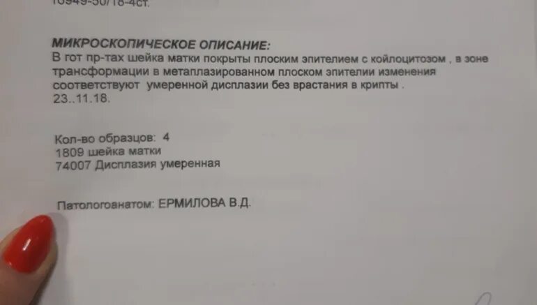 Конизация гистология. Заключение гистологии после конизации шейки. Гистология после конизации шейки. Гистология после конизации шейки матки. Месячные после конизации шейки.