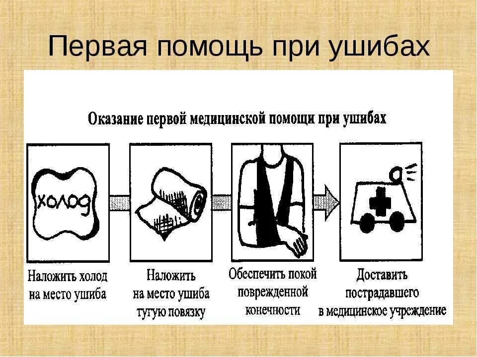 Сильный ушиб первая помощь. Оказание первой доврачебной помощи при ушибах мягких тканей. ПМП при ушибах. Последовательность оказания первой помощи при ушибе мягких тканей. Алгоритм оказания первой доврачебной помощи при ушибе.