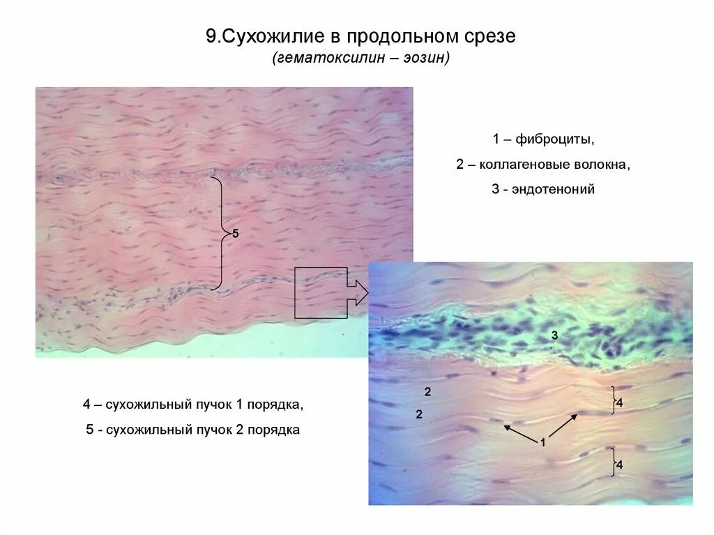 Пучки коллагеновых волокон. Коллагеновые волокна сухожилия. Коллагеновые волокна сухожилия. Коллагеновые волокна сухожилия. Связь мышечных волокон с коллагеновыми волокнами сухожилий.