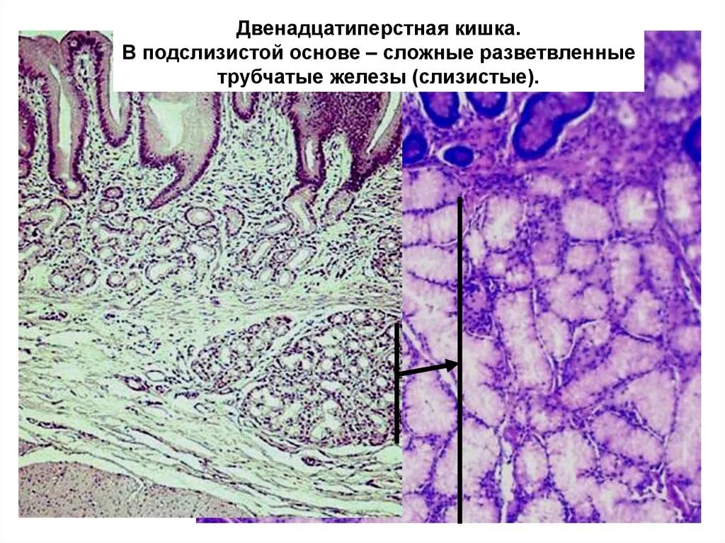 Стенка 12 перстной кишки гистология. Слизистая ЛДПК гистология. Слизистая оболочка 12 кишки