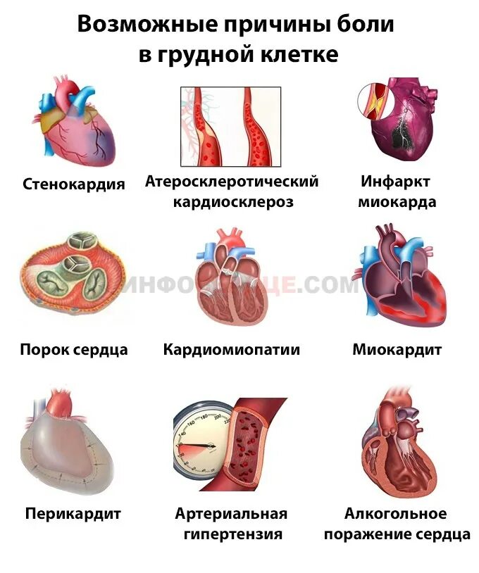 Болит сердце. Болит сердце причины. Отчего может болеть сердце.