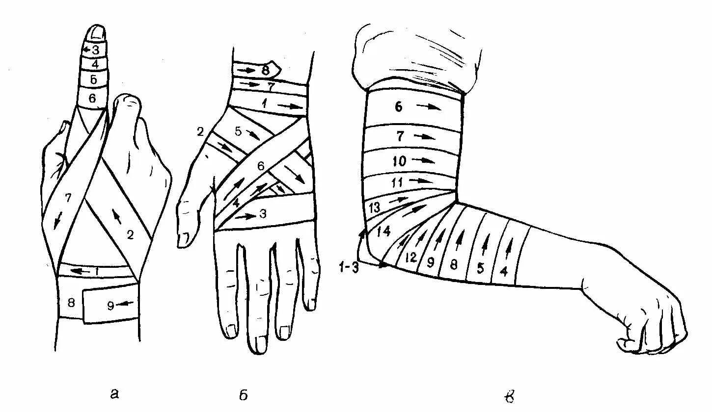 Повязка на руку схема. Бинтование лучезапястного сустава эластичным бинтом. Бинтовые повязки на конечности. Порядок наложения повязки при ранениях верхних и нижних конечностей. Эластичное бинтование верхних конечностей.