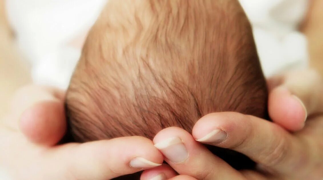 Корочки на голове у ребенка. Корочки на голове у новорожденных. Молочные корочки на голове. Молочные корочки у грудничка.