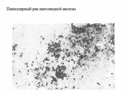 Папиллярные железы