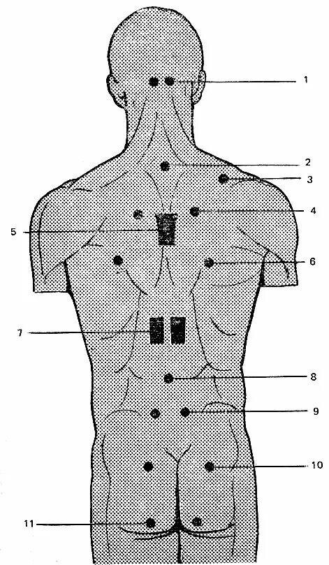Массаж мужчине точки. Акупунктурные точки на пояснице. Акупунктурные точки массаж спины. Акупунктура болевые точки. Болевые точки спины схема.