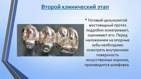 На этап готов