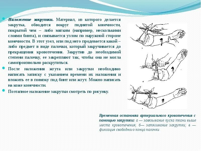 Остановка кровотечения наложение жгута закрутки. Наложение давящей повязки жгута закрутки. Временная остановка наружного кровотечения наложением жгута. Наложение давящей повязки жгута закрутки пальцевое прижатие. Повреждение мелких артерий кистей и стоп