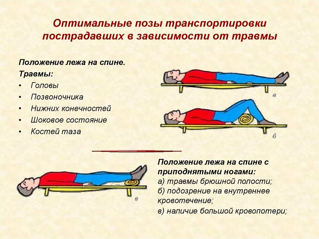 Если при открытом переломе имеется повреждение артерии. Транспортировка пострадавшего при травме верхних конечностей. Оптимальное положение пострадавшего при переломе позвоночника. Транспортировка пострадавшего с травмами позвоночника таза. Вид транспортировки пострадавшего при травме бедра.