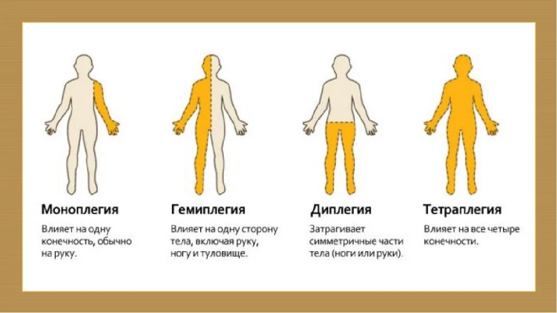 Центральная слабость