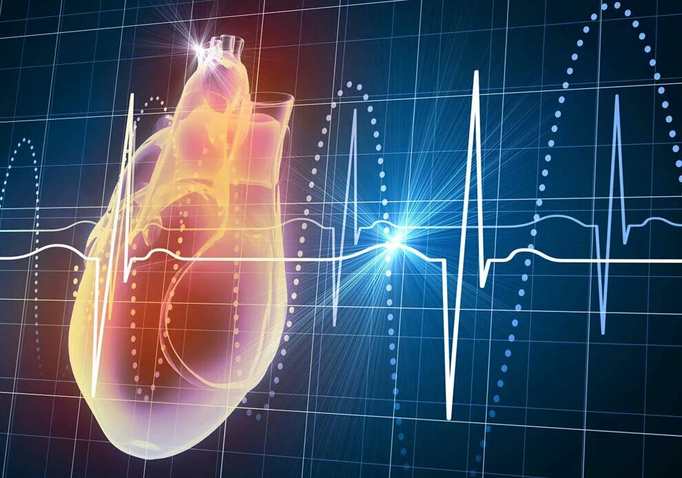 Сердцебиение болезнь. "Ритм" (сердечный). ЭКГ сердца. Красивая кардиограмма. Сердце человека ЭКГ.