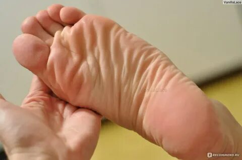 Желтые стопы причины