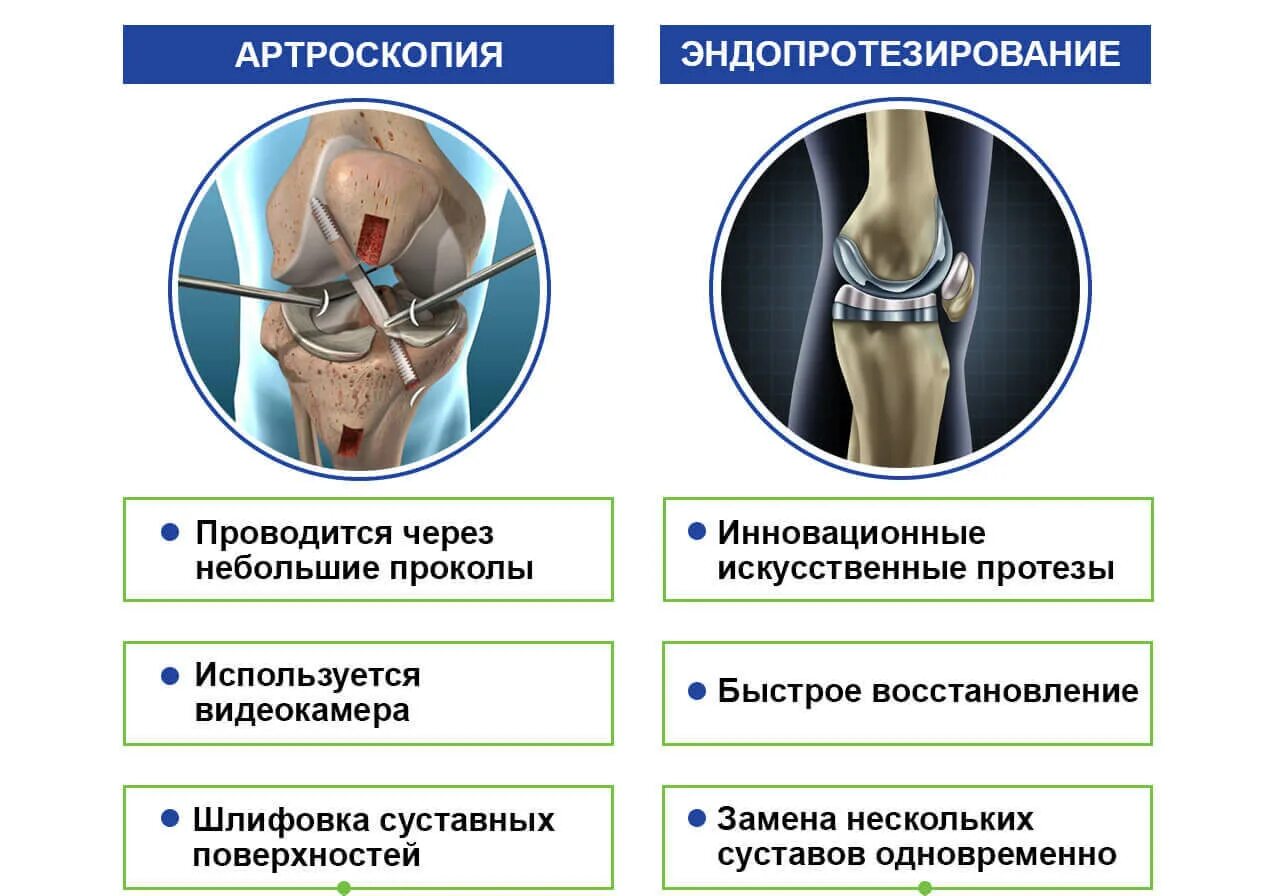 Лечение суставов методики