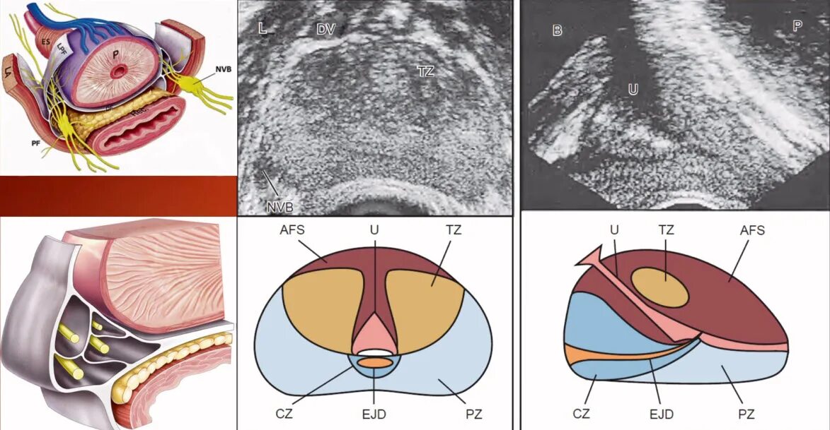 Схема простаты. Трузи предстательной железы анатомия. Зональная анатомия предстательной железы. Зональная анатомия предстательной железы УЗИ. Зональная анатомия предстательной железы мрт.