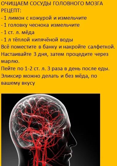 Что чистит мозг. Очищение сосудов головного мозга и шеи. Средство для очищения сосудов головного мозга. Продукты для очищения сосудов головного мозга.