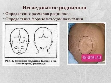 Темечко у новорожденного во сколько зарастает