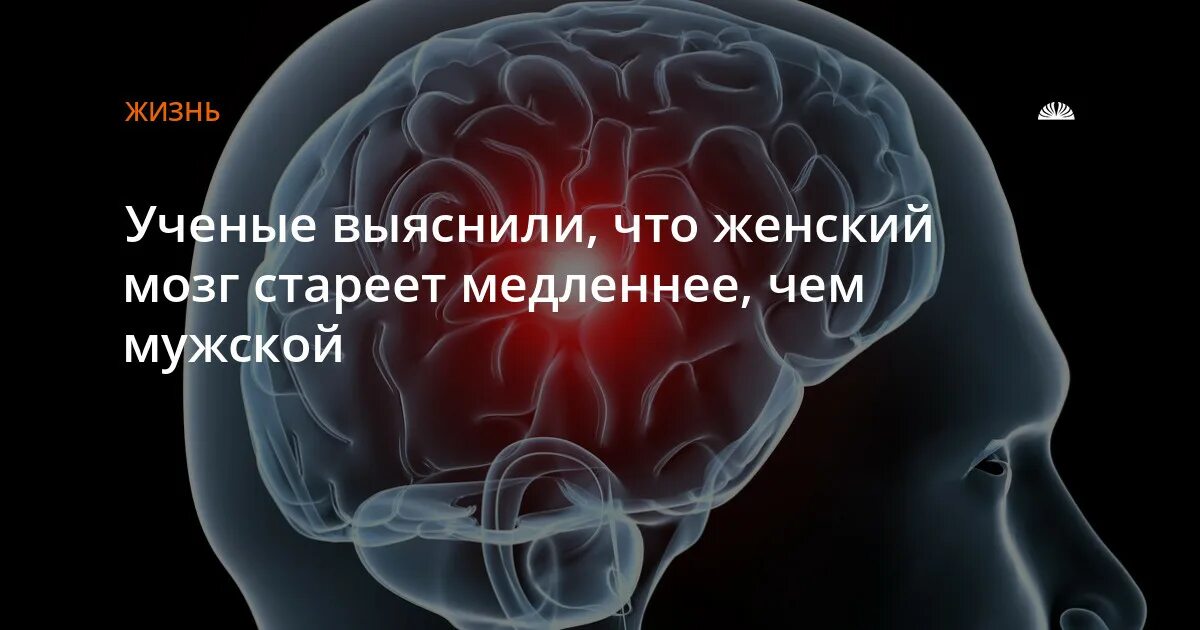 Нестареющий мозг. Мужской и женский мозг. Женский мозг 2017. От чего стареет мозг. Ученые выяснили.