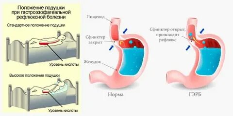Гэрб кровать