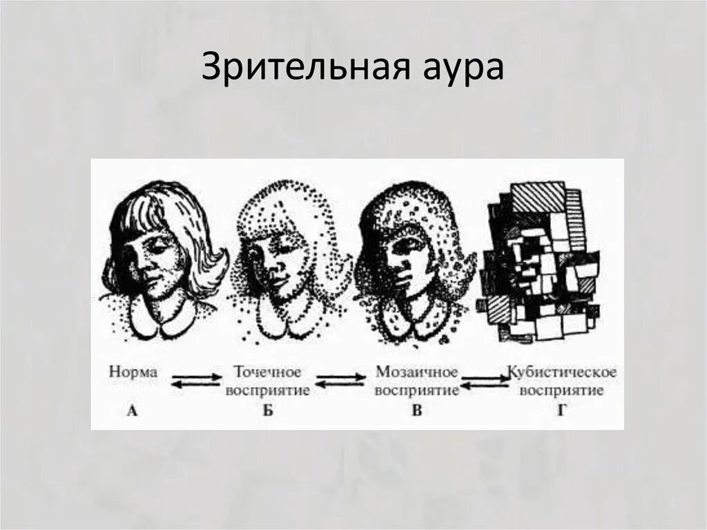 Аура при мигрени что это. Мигренозная Зрительная Аура. Мигрень со зрительной аурой. Глазная мигрень Зрительная Аура. Визуальная Аура при мигрени.