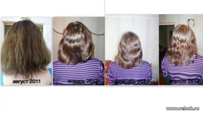 За сколько отрастают волосы у мужчин. Рост волос до и после. Перечная мята для волос до и после.