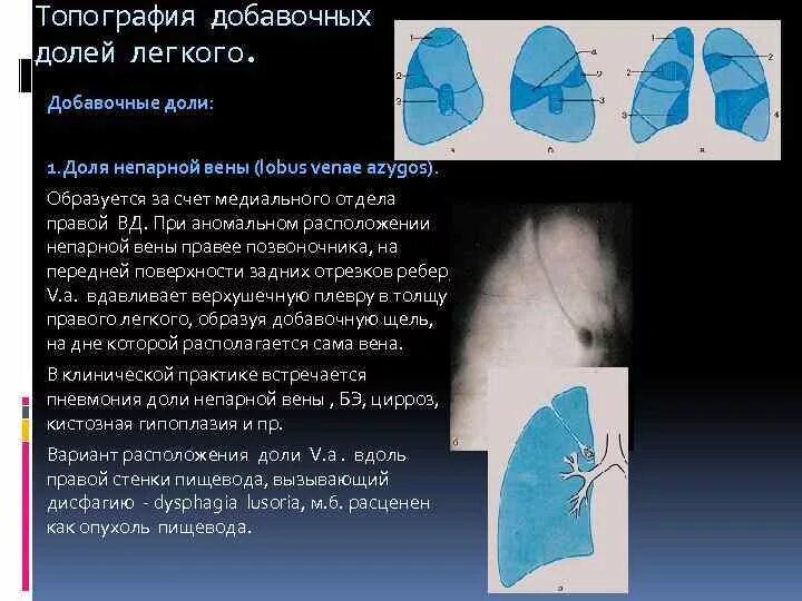 Боли в нижней доле легких. Вена азигос на рентгенограмме легких описание.