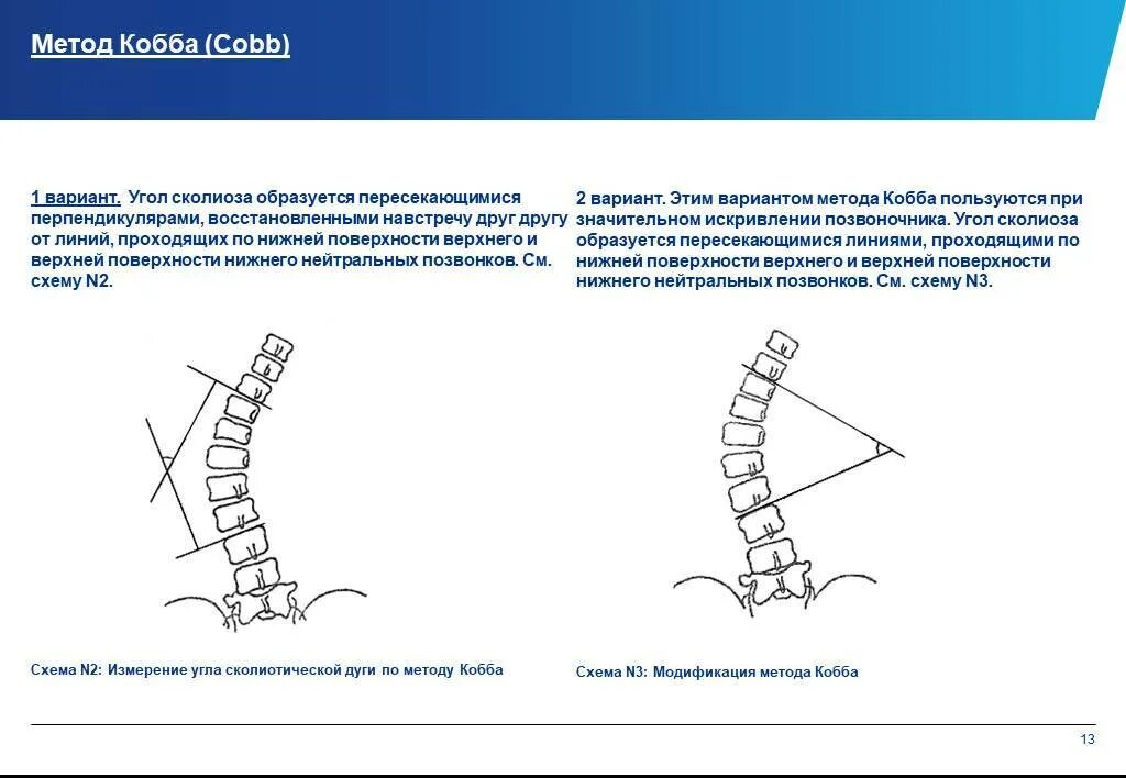 Метод Кобба сколиоз степени. Угол Кобба степени сколиоза. Рентгенологические степени сколиоза по коббу:. Рентген сколиоз угол Кобба. Угол кобба