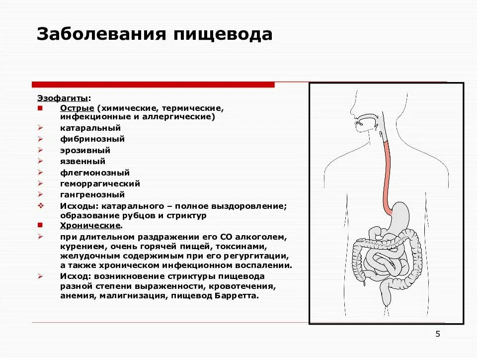 Белый пищевод