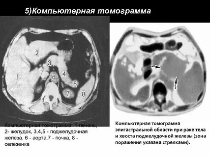 Размеры кт