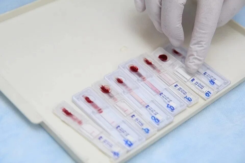 Кровь на вич 1 2. Экспресс-тест на ВИЧ-1/2. Тест-полоски на ВИЧ ISCREEN-HIV (1&2). Экспресс тест на ВИЧ кровь. Экспресс тест на ВИЧ кровь из пальца.