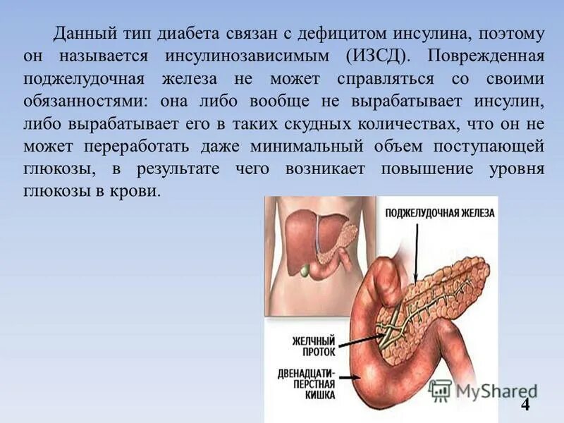 Какое заболевание при недостатке инсулина. СД 1 типа поджелудочной железы. Поджелудочная железа инсулин 2 типа. Поджелудочная железа диабет 1 типа.