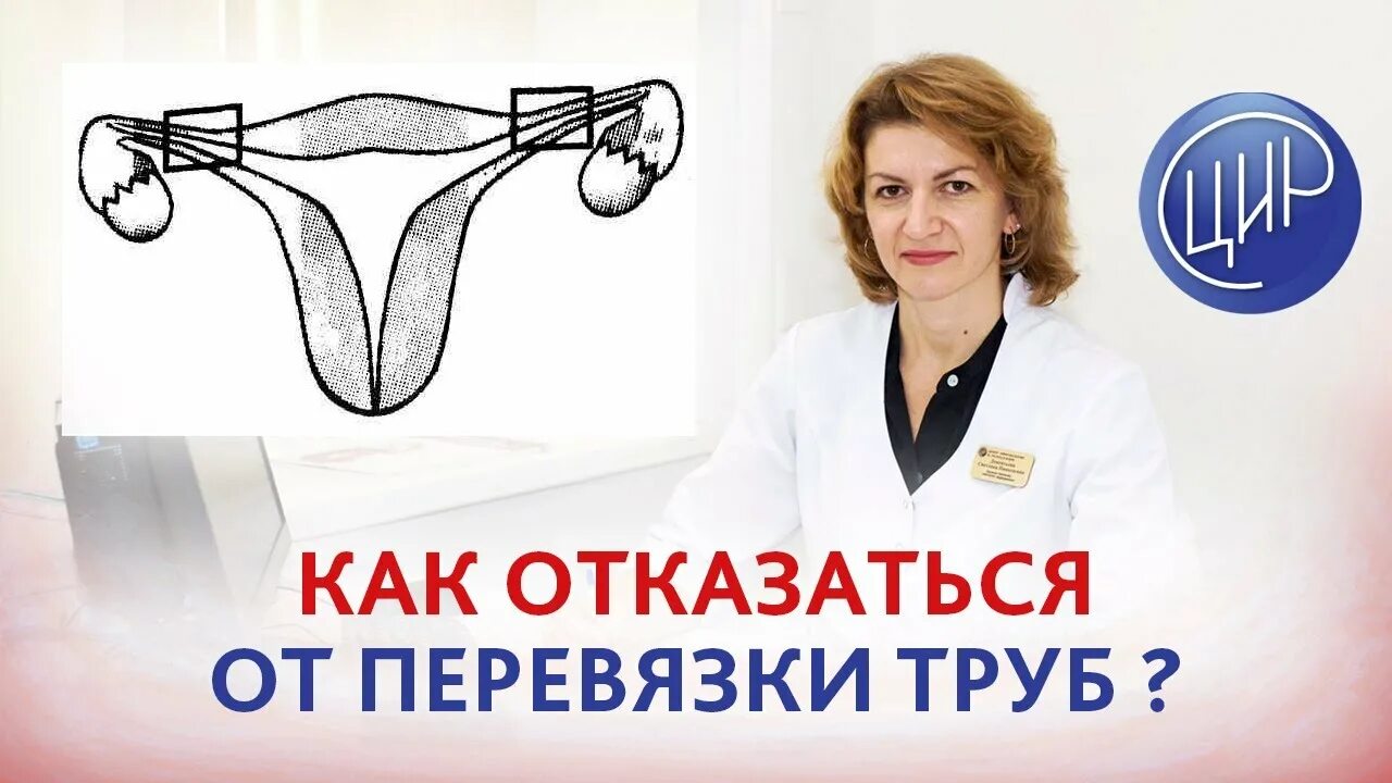 Перевязать трубы после родов. Перевязка труб у женщин. Как забеременеть если перевязаны трубы. Как перевязывают трубы у женщин.