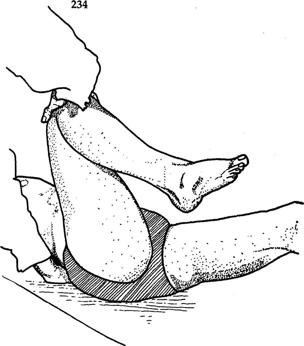 положение нога согнута в коленном суставе. постизометрическая релаксация грушевидной мышцы упражнения. больно согнуть ногу в тазобедренном суставе. больно согнуть ногу в тазобедренном суставе. сгибание ноги в коленном суставе.