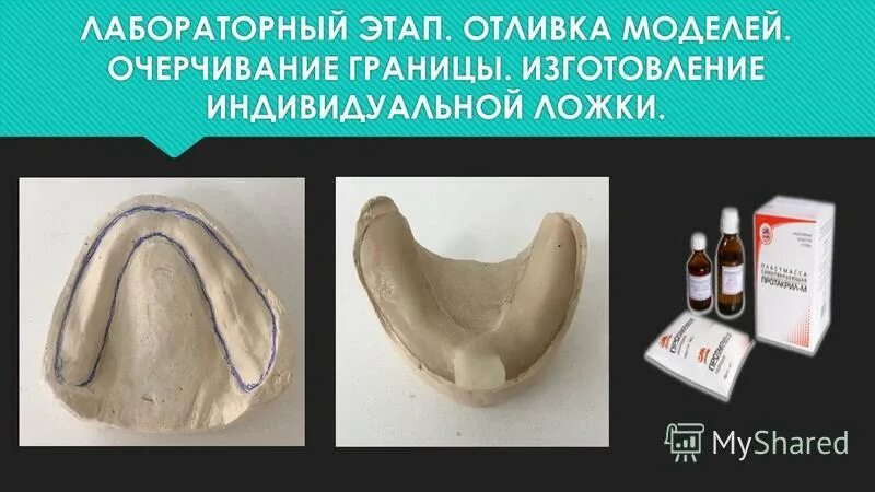 границы индивидуальной ложки на нижней челюсти. припасовка индивидуальной ложки. границы индивидуальной ложки. индивидуальная ложка изготовление из пластмассы. границы индивидуальной ложки.