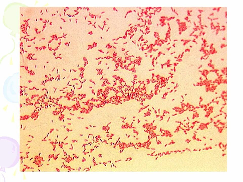 Haemophilus spp у мужчин. Иерсиния пестис микроскопия. Окраска сальмонелл по грамму. Синегнойная палочка микроскопия. Pseudomonas aeruginosa микробиология.