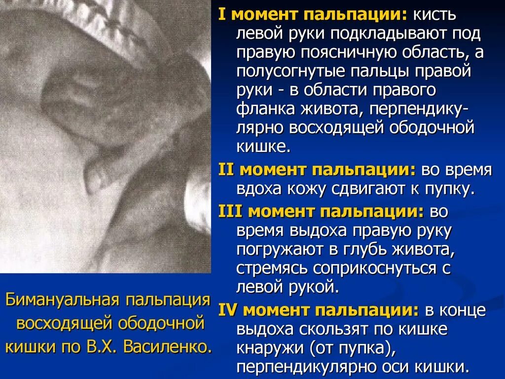 Пальпация живота. Бимануальная пальпация восходящей. Пальпация кишечника пропедевтика. При глубокой пальпации живота. Пальпация органов пищеварения.