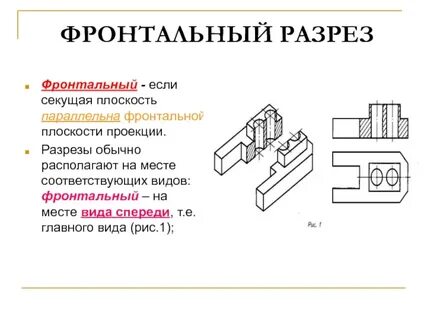 Передний разрез