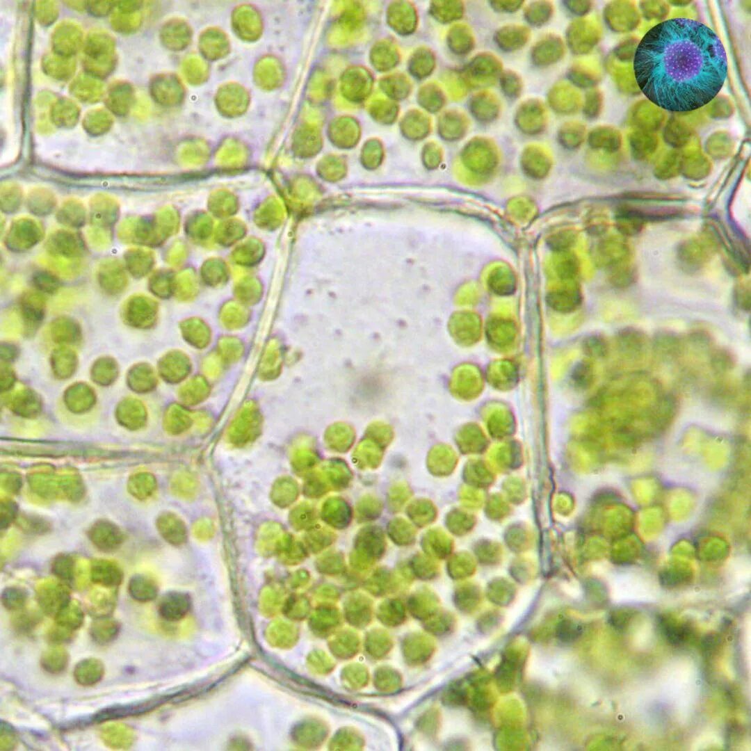 Растительная клетка лабораторная. Хлоропласты в листе валлиснерии. Строение клетки листа валлиснерии. Хлоропласты листа под микроскопом. Валлиснерия строение клетки.