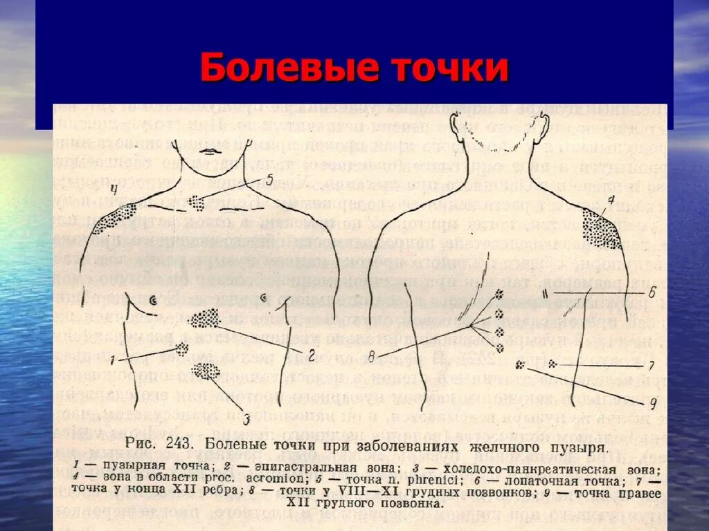 Болевые точки желчного пузыря Маккензи. Болевые точки желчного пузыря проекция. Точка проекции желчного пузыря. Болевые точки при холецистите.