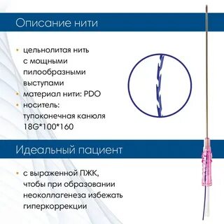Молдинг отзыв