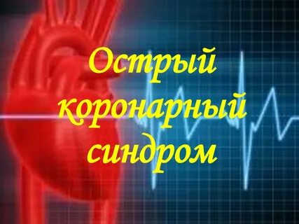 Острый коронарный синдром сердце