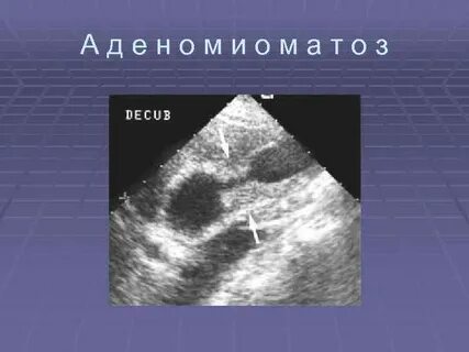Амур узи