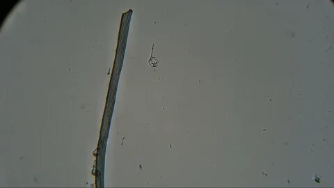 Морская вода под микроскопом