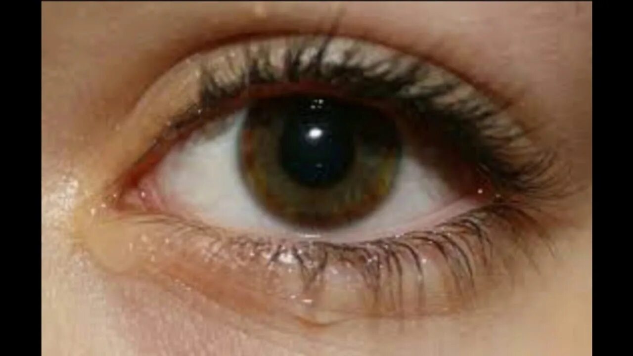 Почему чешется глаза у женщин. Слиязтся и красные глаза.