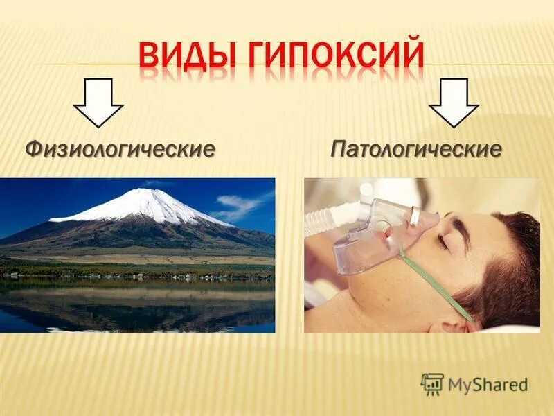Как выглядит гипоксия глаза Виды гипоксий таблица