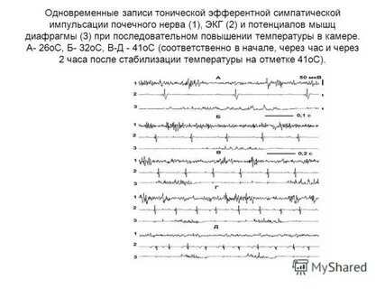 Запись одновременная