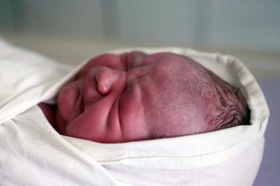 зебренок новорожденный. новорожденный ребенок. новорожденный малыш. как выглядят новорожденные фото. новорожденный ребеночек в роодоие.