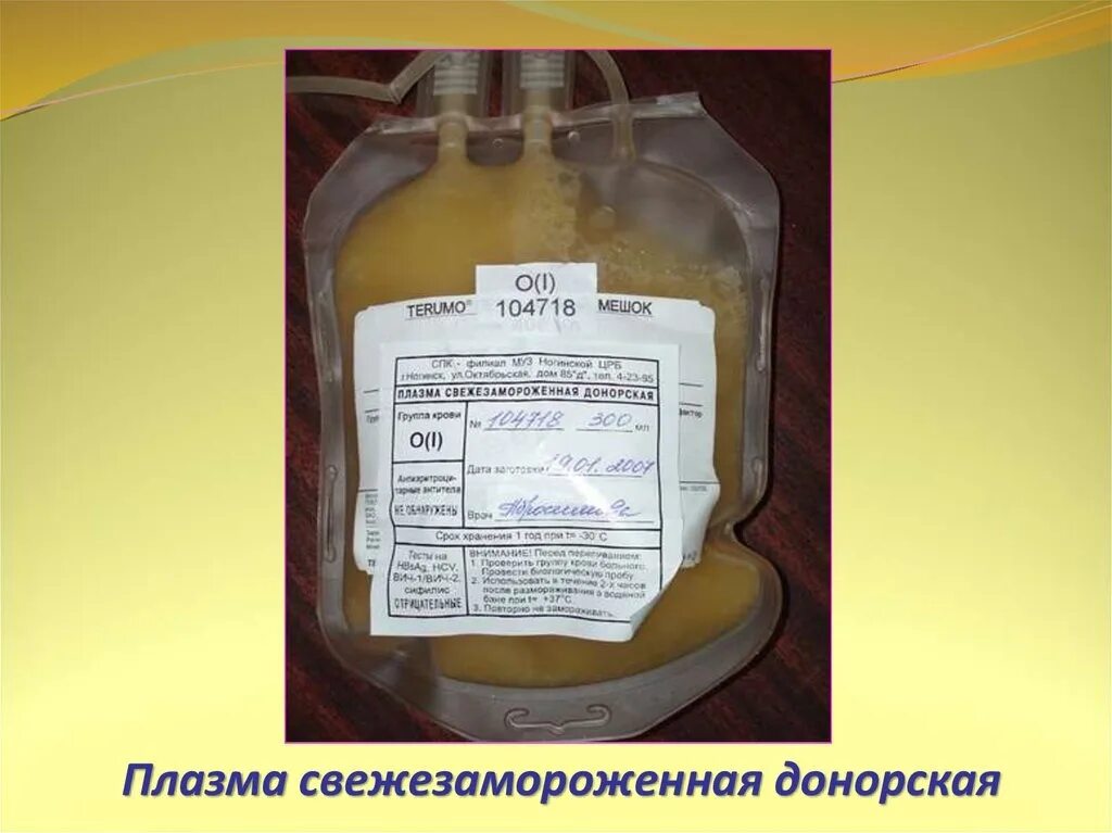 Переливание свежезамороженной плазмы. Тромбоконцентрат аферезный. Криопреципитат и плазма. Свежезамороженная плазма (сзп). Плазма нативная свежезамороженная сухая.