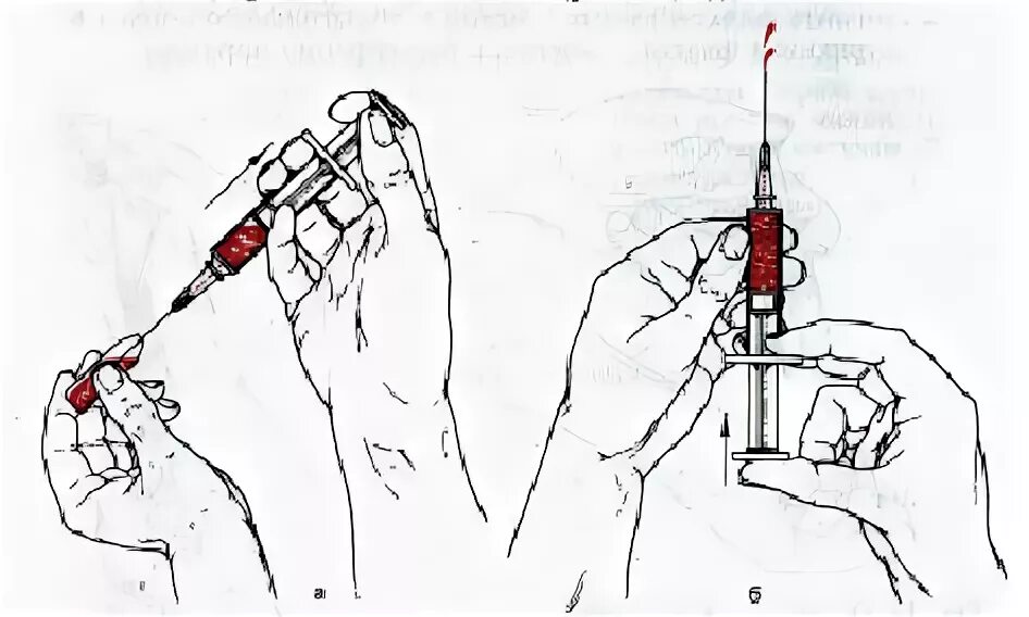 Алгоритм набирания лекарства из ампулы в шприц. Набор в шприц лекарственного раствора из ампулы. Набирание лекарственного средства из ампулы алгоритм. Алгоритм набирания раствора в шприц из ампулы. Уколы вытекают почему