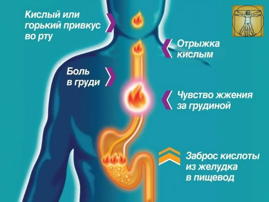 Горечь во рту после отрыжки. Симптомы изжоги желудка. Основные причины изжоги.